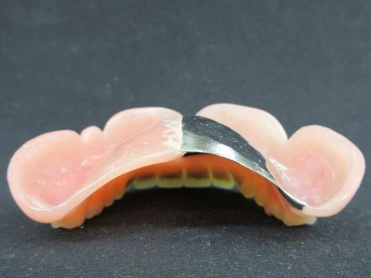 金属床義歯 - こころ歯科大和クリニック入れ歯・義歯専門サイト（大和市）
